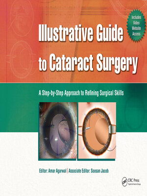 cover image of Illustrative Guide to Cataract Surgery